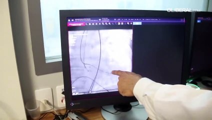 Tavi: procedimento trata doença cardíaca sem cirurgia