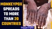 Monkeypox spreads to more than 20 countries, global tally reaches 200 | OneIndia News