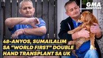 48-anyos, sumailalim sa “world first” double hand transplant sa UK | GMA News Feed