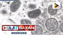 DOH, puspusan ang paghahanap ng source ng bakuna kontra monkeypox
