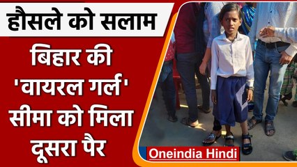 Jamui Viral Girl Seema को मिला दूसरा पैर, Social Media पर यूजर्स ने की तारीफ | वनइंडिया हिंदी
