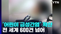 '어린이 급성 간염' 600건 넘게 발병...원인 규명은 '깜깜' / YTN