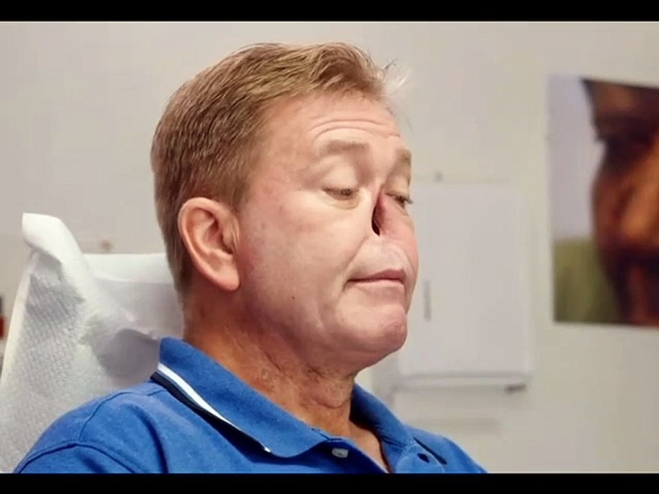 كل مايريده هي فقط انف  | He just wants a nose  اشتركووو بقي اجدعان