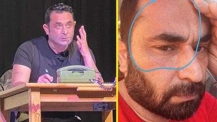 Oyuncu Serkan Aydın, Avusturya'da saldırıya uğradı