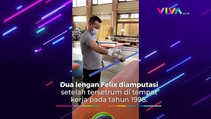 Begini Kondisi Pria Jalani Transplantasi Lengan Ganda