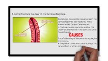 Penile Fracture - Can your P*nis get broken