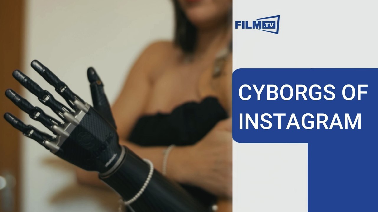Cyborgs of Instagram: Social-Media-Stars mit Behinderung