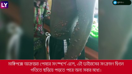 Monkeypox নিয়ে সতর্কতা, আক্রান্তরা দূরে থাকুন পোষ্য থেকে