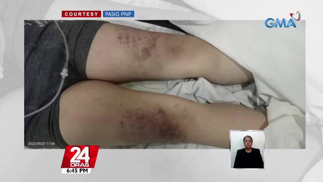 8-anyos na bata, nasawi matapos umanong pagbuhatan ng kamay ng mga magulang | 24 Oras