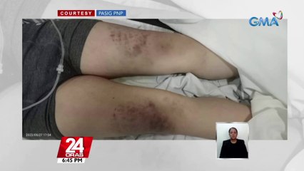 8-anyos na bata, nasawi matapos umanong pagbuhatan ng kamay ng mga magulang | 24 Oras