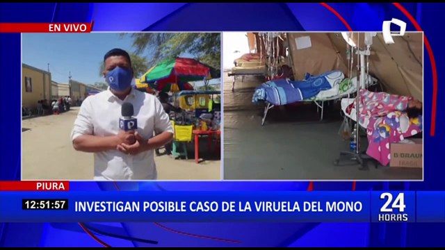 Viruela del mono en el Perú: reportan primer caso sospechoso en Piura