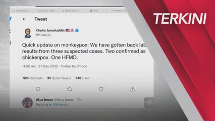 [TERKINI] KJ sahkan dua kes cacar air, satu kes HFMD