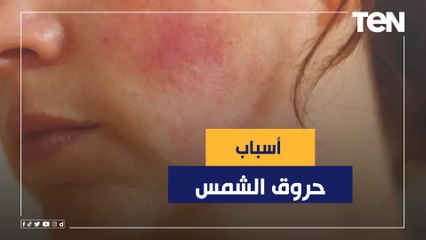 تعرف على أسباب وطرق علاج تساقط الشعر