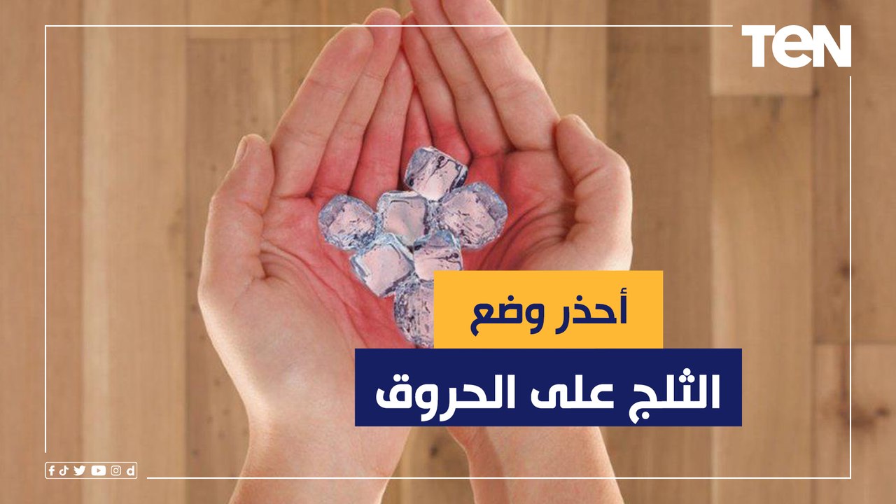 ابتعد عن الثلج.. هاني الناظر يكشف أخطاء علاج حروق الجلد