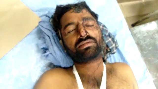 कोटा में शादी समारोह में दो पक्षों में संघर्ष, 8 लोग घायल