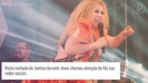 Rosto inchado de Joelma em show chama atenção de fãs; cantora explica motivo. Veja!