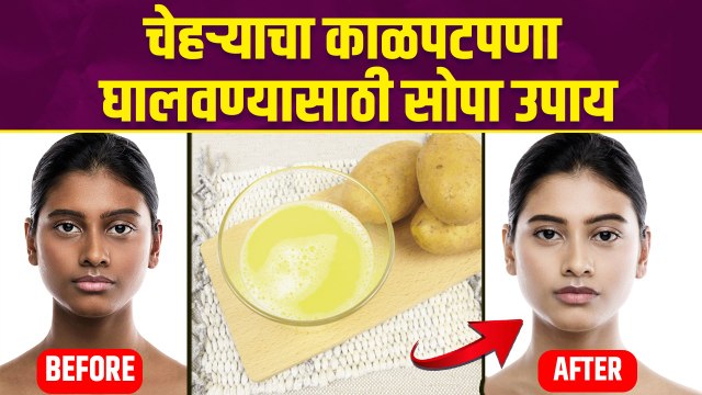 काळवंडलेल्या चेहऱ्यावर करा हा उपाय |How to Remove Sun Tan Naturally | Sun Tan Removal Home Remedies