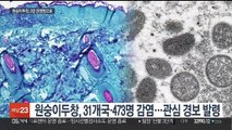 원숭이 두창 '관심' 경보 발령…2급 감염병 지정