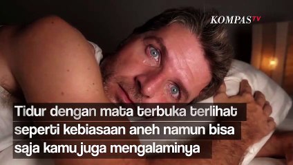 Penyebab Orang Tidur dengan Mata Terbuka, Penyakit Serius?