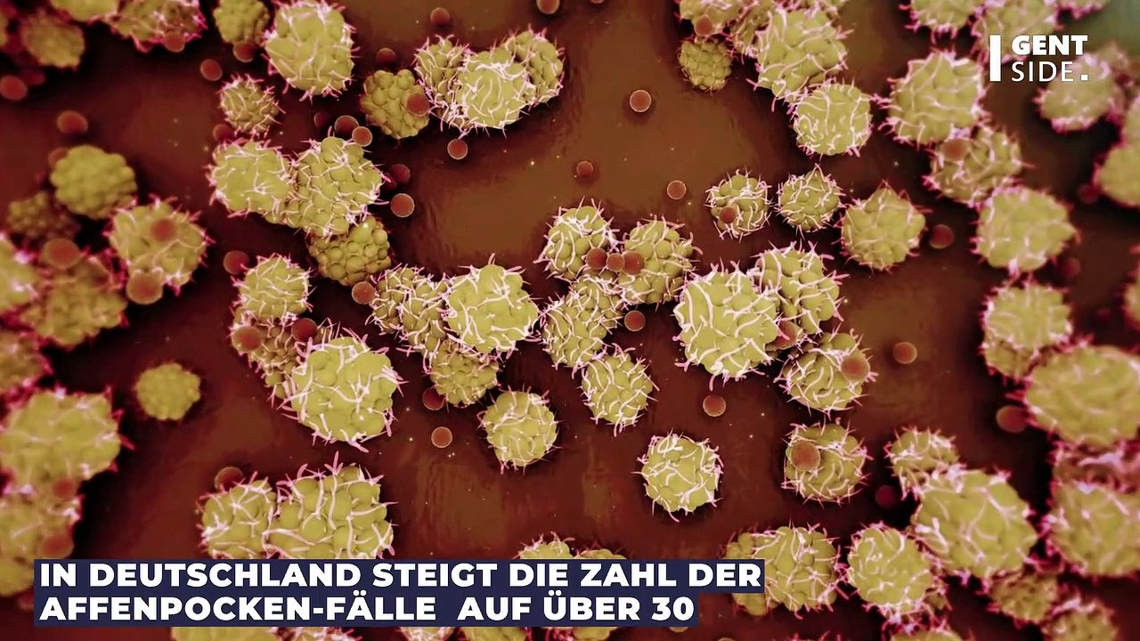 Affenpocken: Was du tun solltest, wenn du vermutest, dich angesteckt zu haben