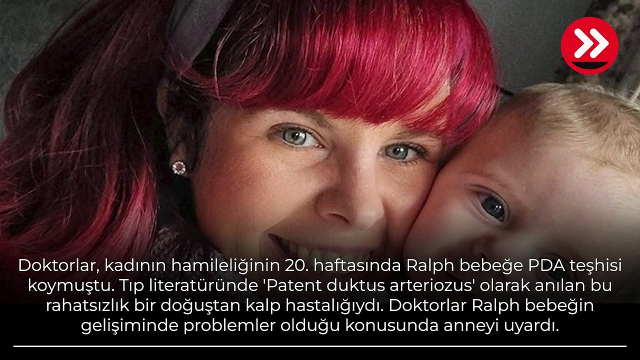 Ayla bebeğin büyük dramı! Gülümsediğini sanıyorlar ama gerçek başka