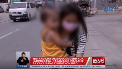 Batang may ambiguous genitalia, laging kasa-kasama ng ina | UB