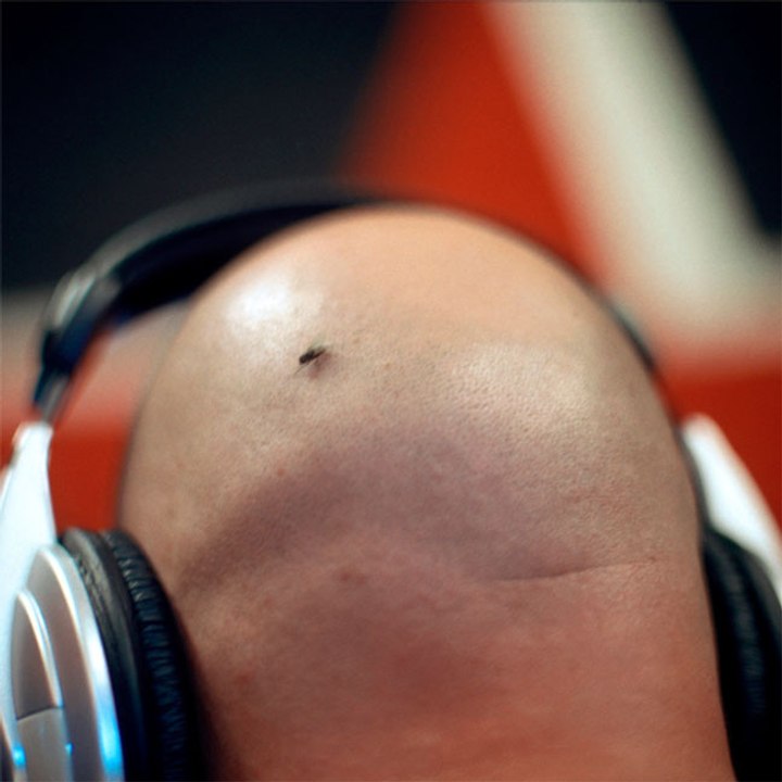 Glatzköpfige Männer sind bald eine gefährdete Spezies