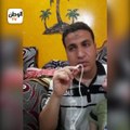 الطفل «محمد» يبكي القلوب.. أصيب بمرض نادر حرمه من طفولته- نفسه يعيش زي غيره