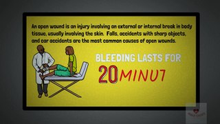 Types of Open Wounds (Abrasion, Laceration, Skin Avulsion, Puntured wounds)