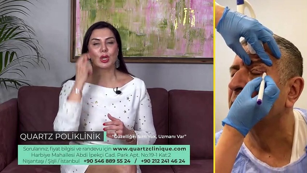 Göz Kapağı Ameliyatı Sonrası İyileşme Ne Zaman Olur? | Op. Dr. Leyla ARVAS