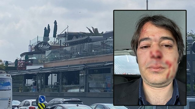 Saldırıya uğrayan İBB İmar Müdürü Ramazan Gülten o anları anlattı