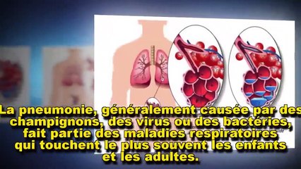 7 aliments pour soigner la pneumonie