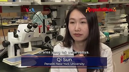 Peneliti Berhasil Ungkap Alasan Ilmiah Rambut Beruban