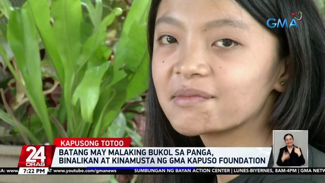 Batang may malaking bukol sa panga, binalikan at kinamusta ng GMA Kapuso Foundation | 24 Oras