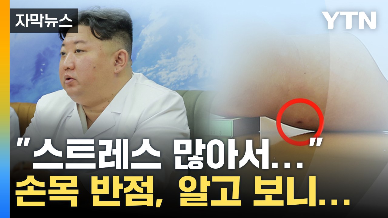 [자막뉴스] "스트레스 많아서" 김정은 손목 반점, 알고 보니... / YTN