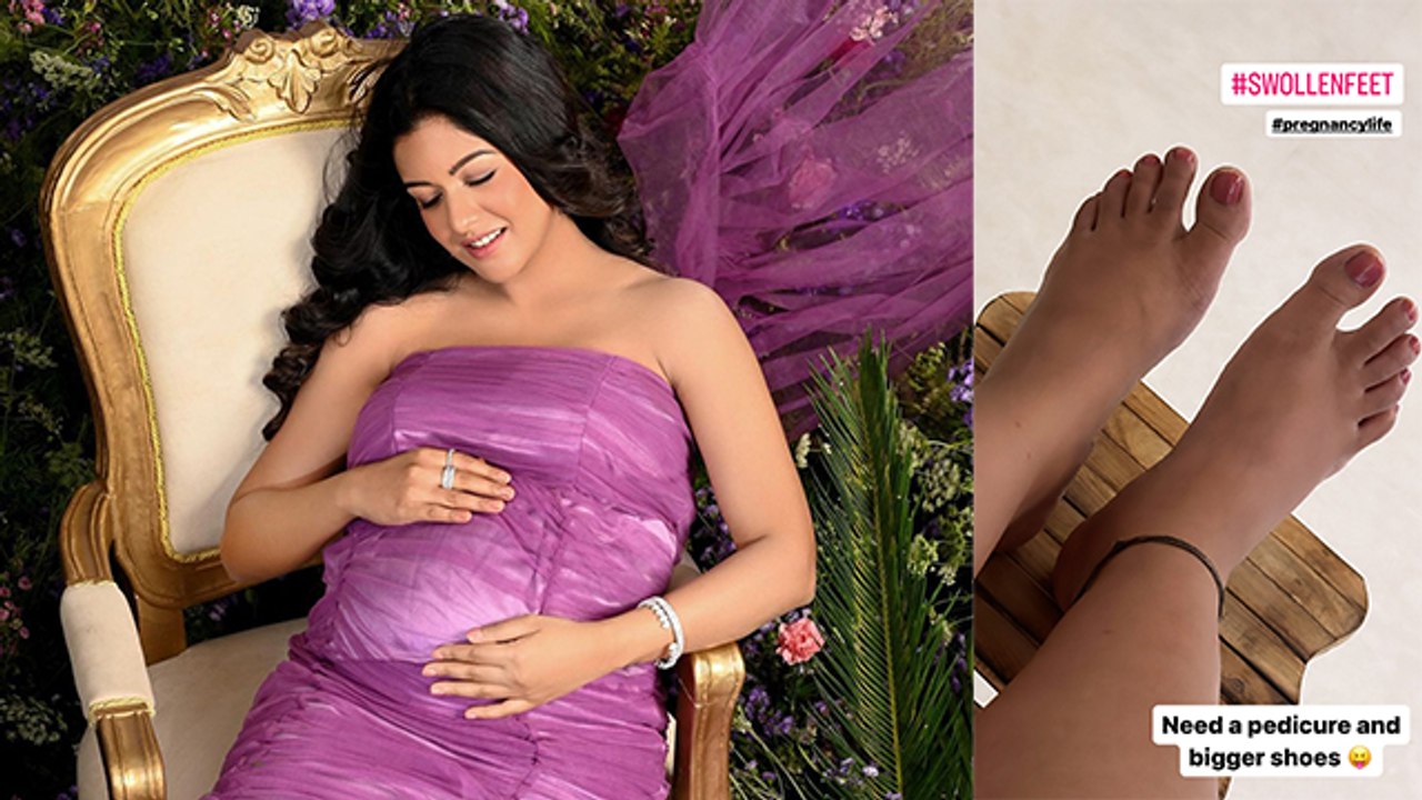 प्रेगनेंसी में पैरों में सूजन क्यों आती है | Pr...