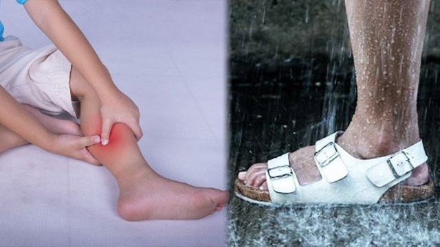 बारिश के दिनों में पैर दर्द क्यों होता है | Barish Ke Dino Me Pair Dard Kyu Hota Hai | Boldsky