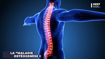 Quelle est la “maladie des os de verre”, dont était atteint l’humoriste Guillaume Bats