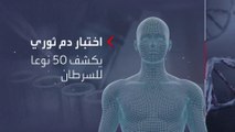 تجربة بريطانية رائدة تكشف أنواع السرطان المختلفة عن طريق فحص دم