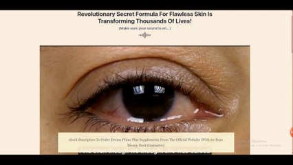 Derma Prime Plus My Epic Journey to Acne-Free Skin!