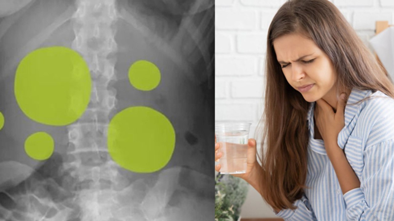 खाना खाने के बाद हिचकी क्यों आती है | Khana khane ke bad hichki kyon aati hai | Boldsky *Health