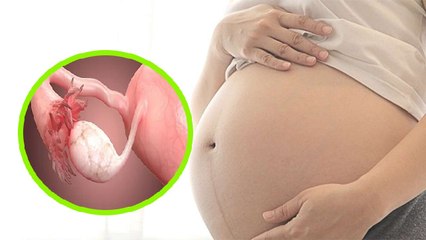 Period आने पर भी Egg Release नहीं होना क्या है, Anovulation Symptoms | Boldsky *Health