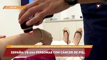 España: 78.000 personas con cáncer de piel