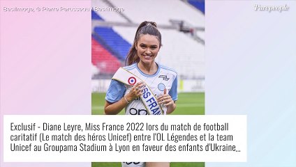 "J'aurais pu perdre la vue" : révélation de Diane Leyre (Miss France) sur l'origine de sa cicatrice