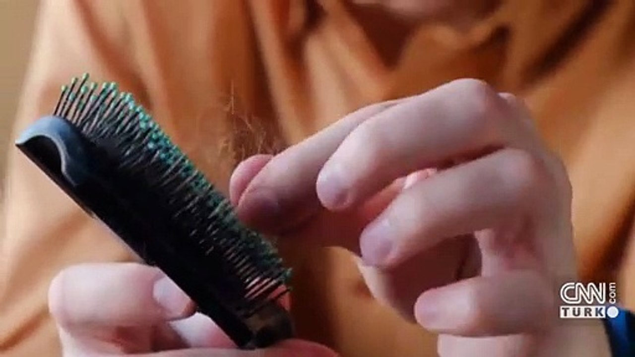 Saçkırana ilk umut ışığı