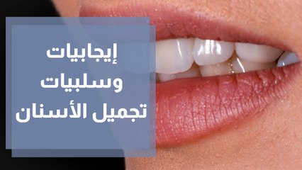 خيارات تجميل الأسنان .. الإيجابيات والسلبيات