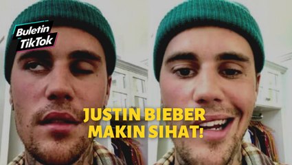 Justin Bieber makin sihat!