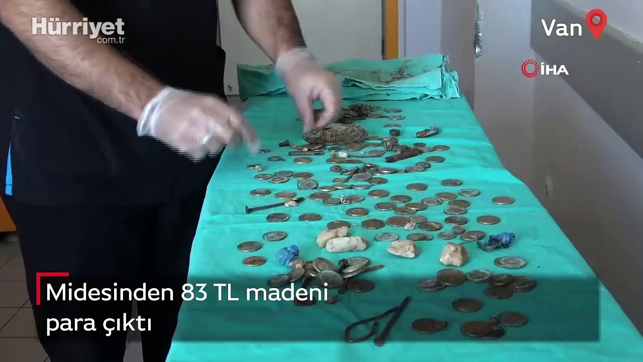 Midesinden 83 TL madeni para çıktı
