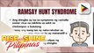 SAY NI DOK | Alamin ang patungkol sa sakit ni Justin Bieber na ramsay hunt syndrome