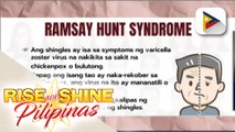 SAY NI DOK | Alamin ang patungkol sa sakit ni Justin Bieber na ramsay hunt syndrome